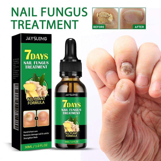 Jaysuing 7DAYS Ginger Anti Fungal Infection Foot Toe Nail with Fungus Treatments Oil Essence